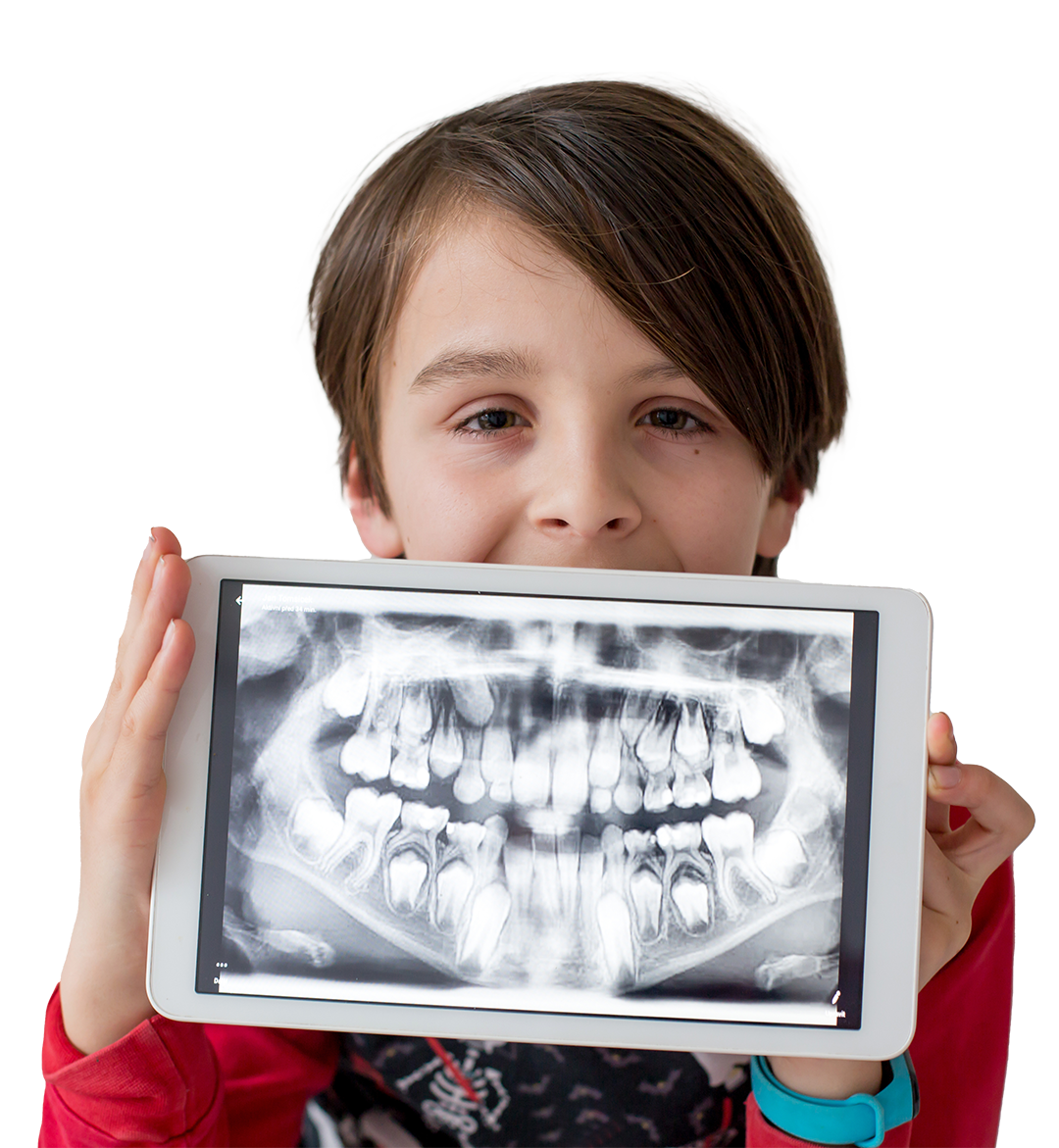 Digital X-Rays Alabaster AL. A child holds up a tablet displaying a digital x-ray of his teeth on the screen.