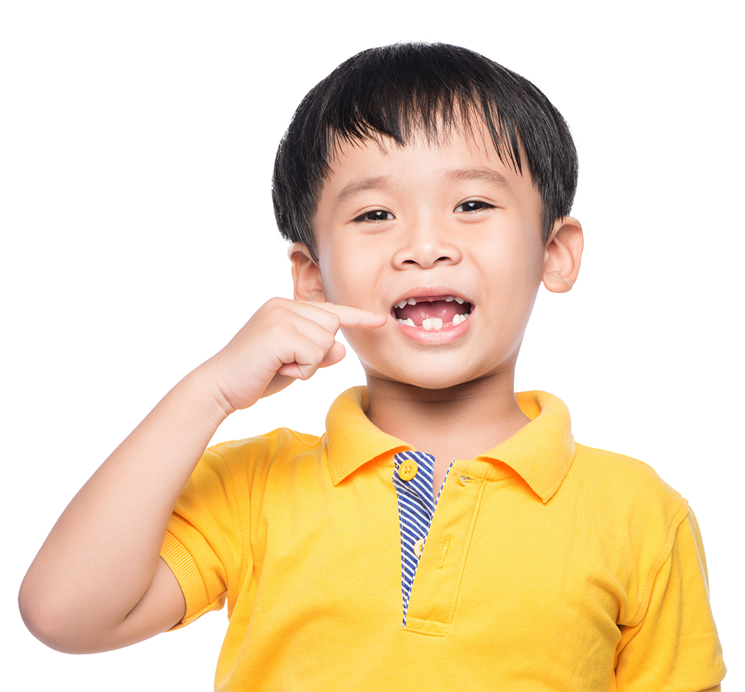 Space Maintainers Alabaster AL. A child points to his teeth where his baby teeth have recently fallen out.