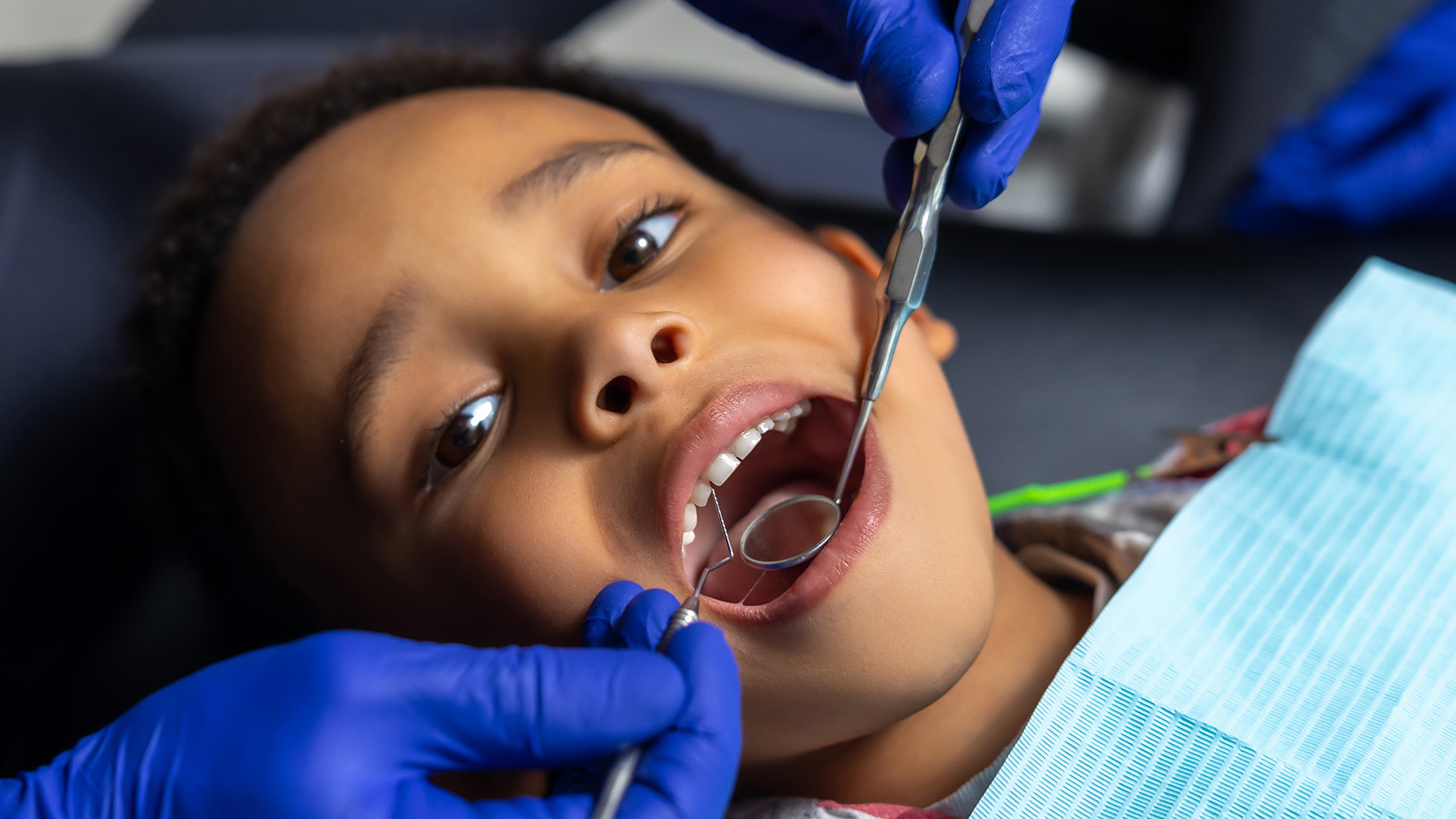 Teeth restoration, dental restorations and restoration teeth