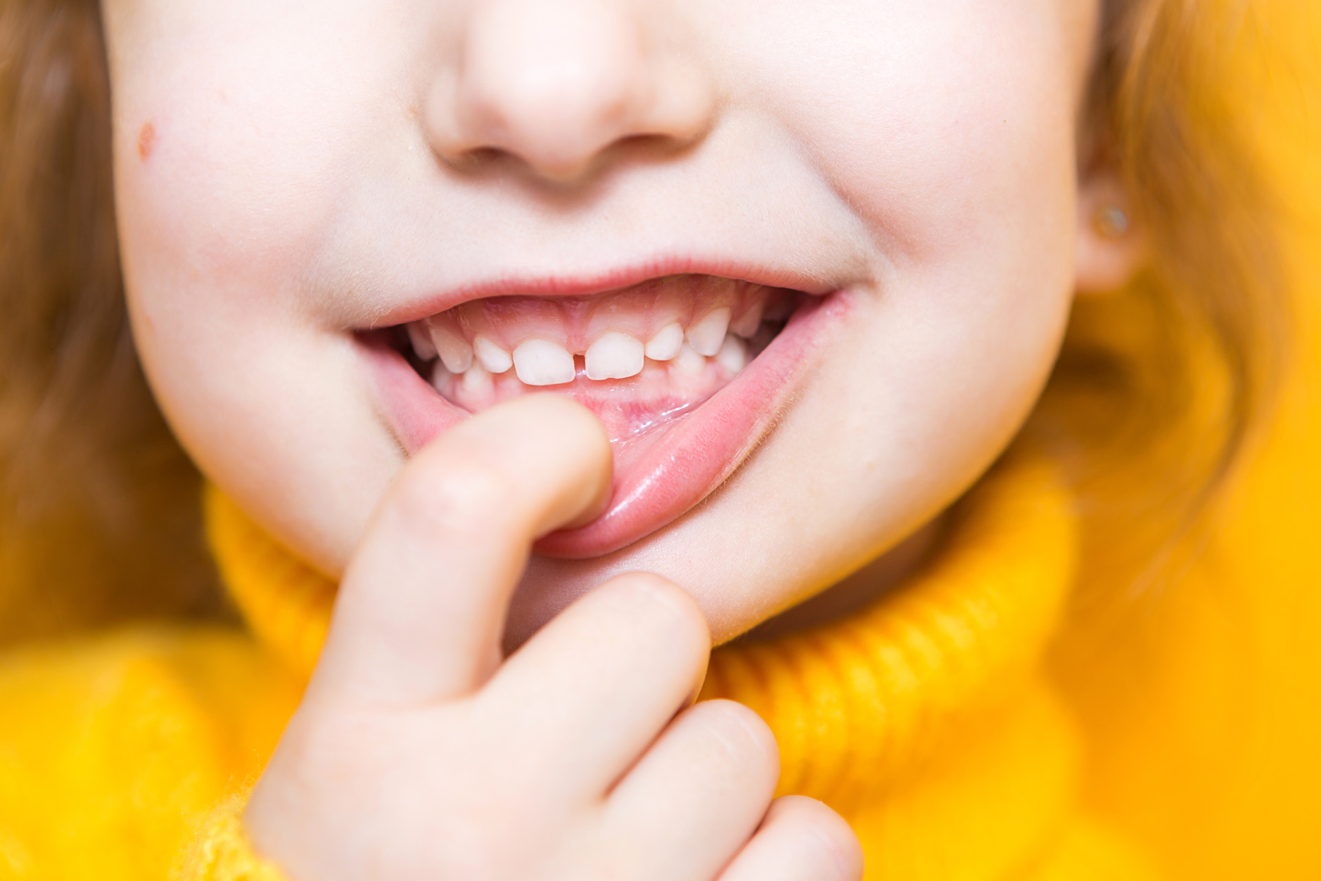 How to prevent cavities and how to prevent tooth decay