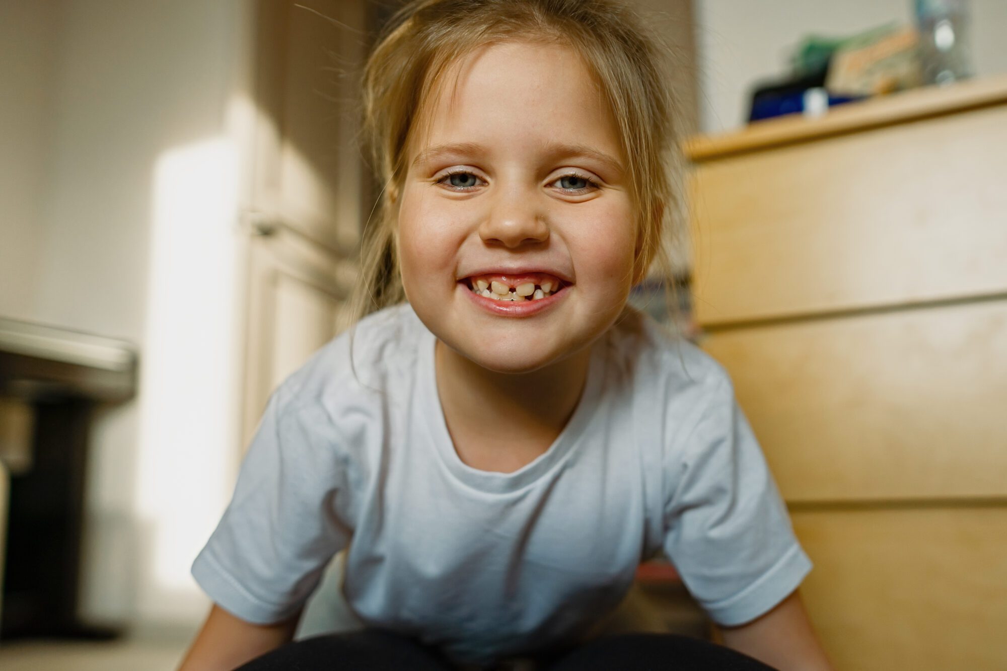 Why are my kid's teeth chipping