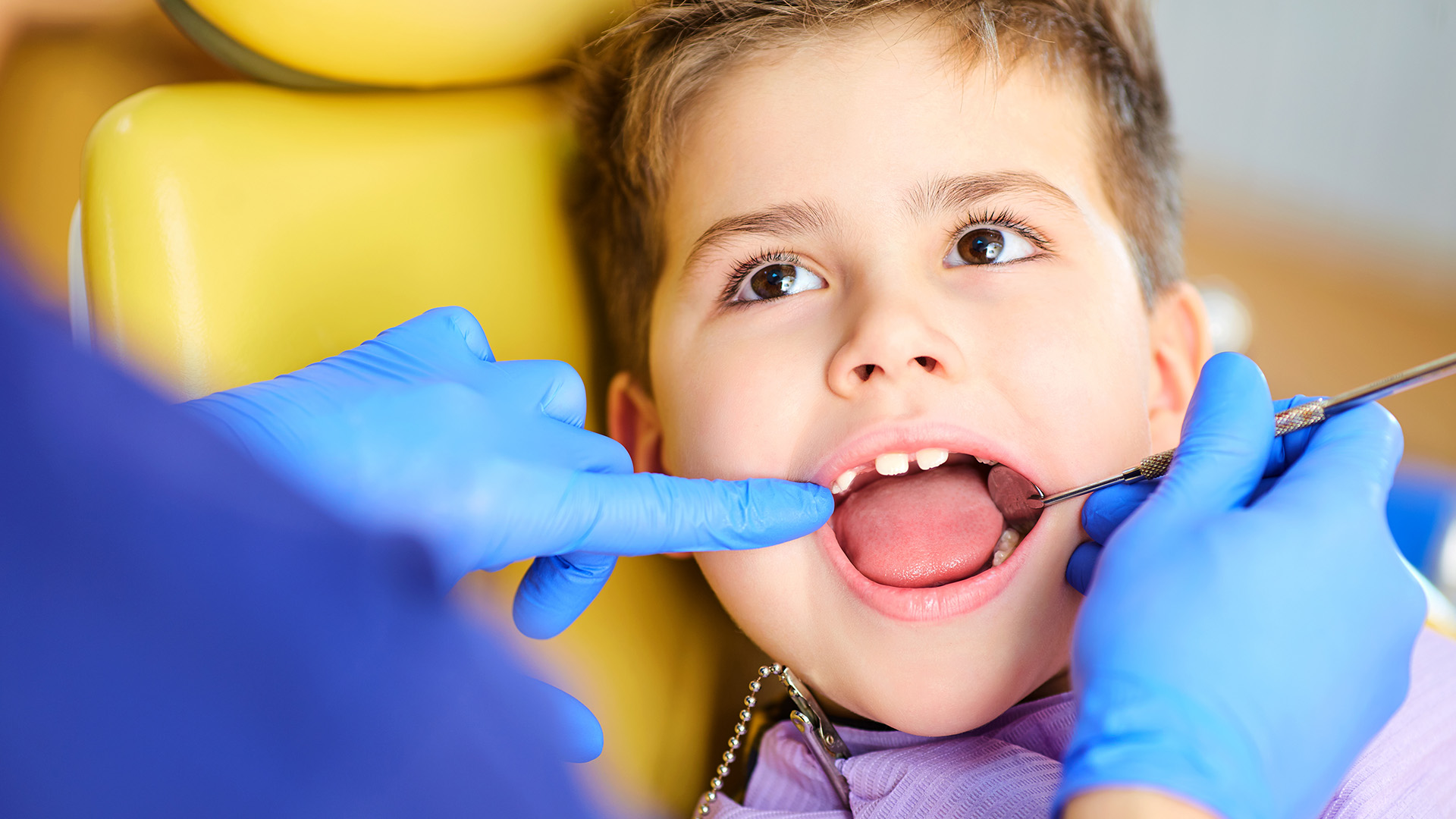 Dental Age Milestones