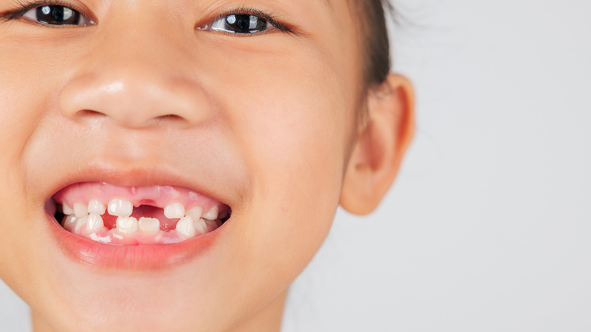 How Long Should It Take a Permanent Tooth to Grow In After a Baby Tooth Falls Out?