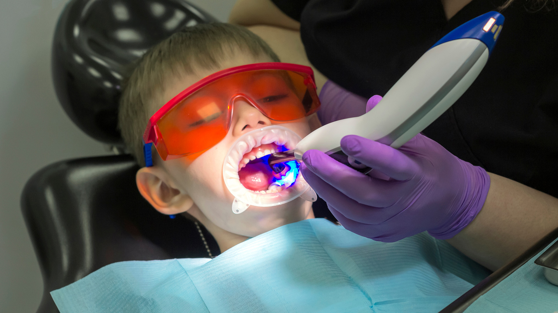 Pulpotomy vs. Pulpectomy: Clear Guidance for Parents Choosing the Best Care