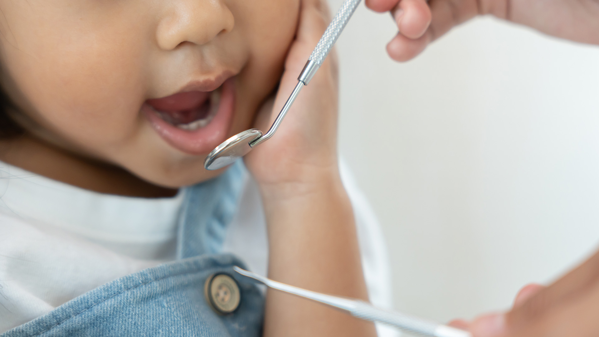 Preventive Dentistry for Kids